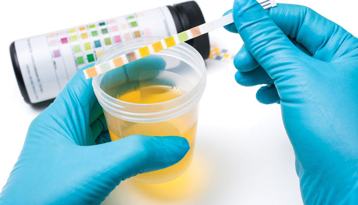 Know Your Drug & Alcohol Test Procedures
